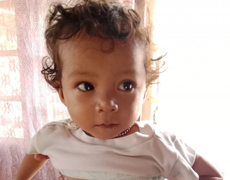 Bocah Asal Guruapin Halsel yang Lahir Tanpa Anus Bakal Jalani Operasi di Manado